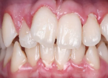 best-dentist-for-nri-patients-in-surat